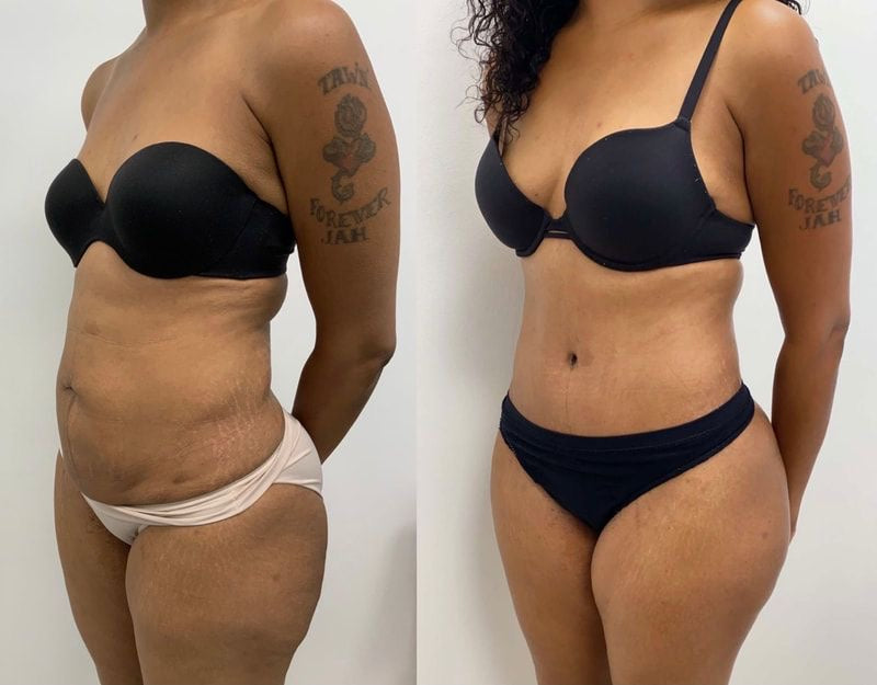 Belly fat melter kit