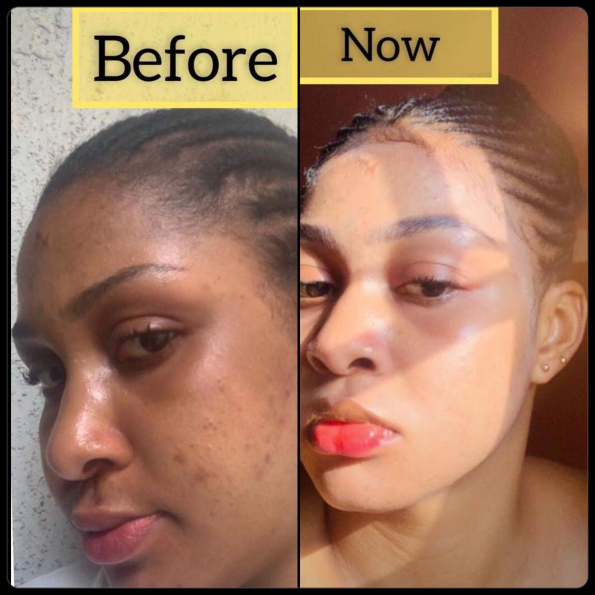 Extreme Kit essentials kit