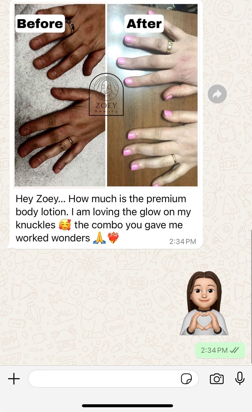 What Zoey Used to get white