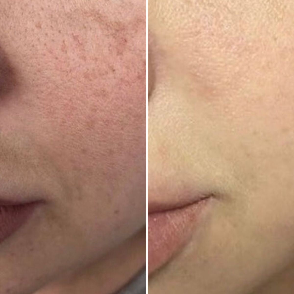 Dark spots