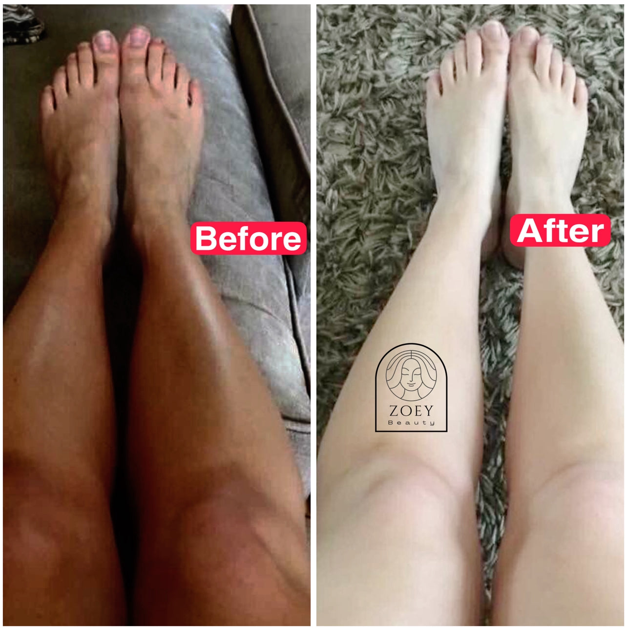 Premium body lotion