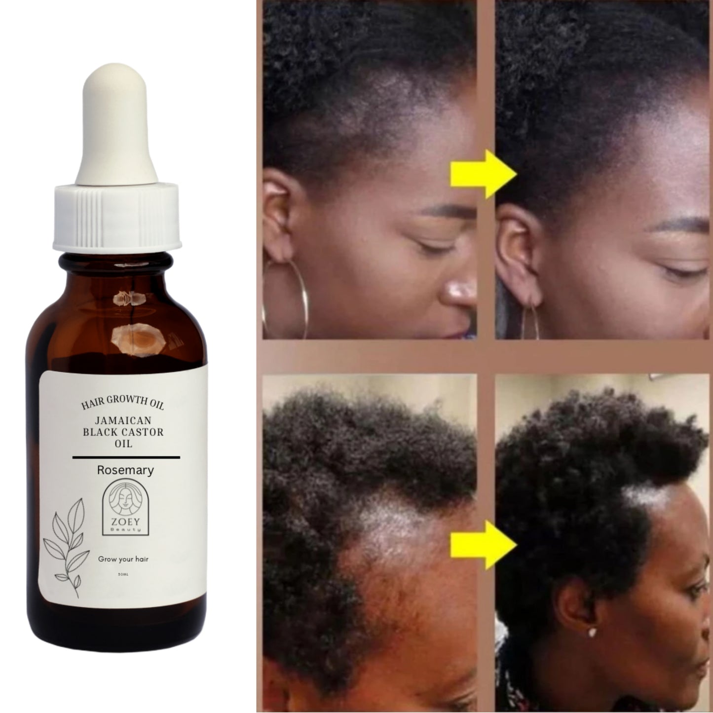 Hair growth serum